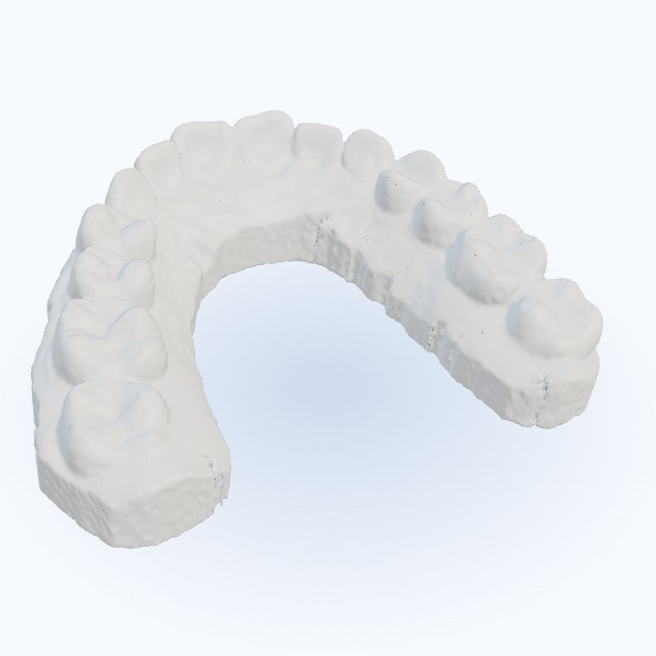 Rotating 3D preview of an upper dental arch scan, molars to incisors
